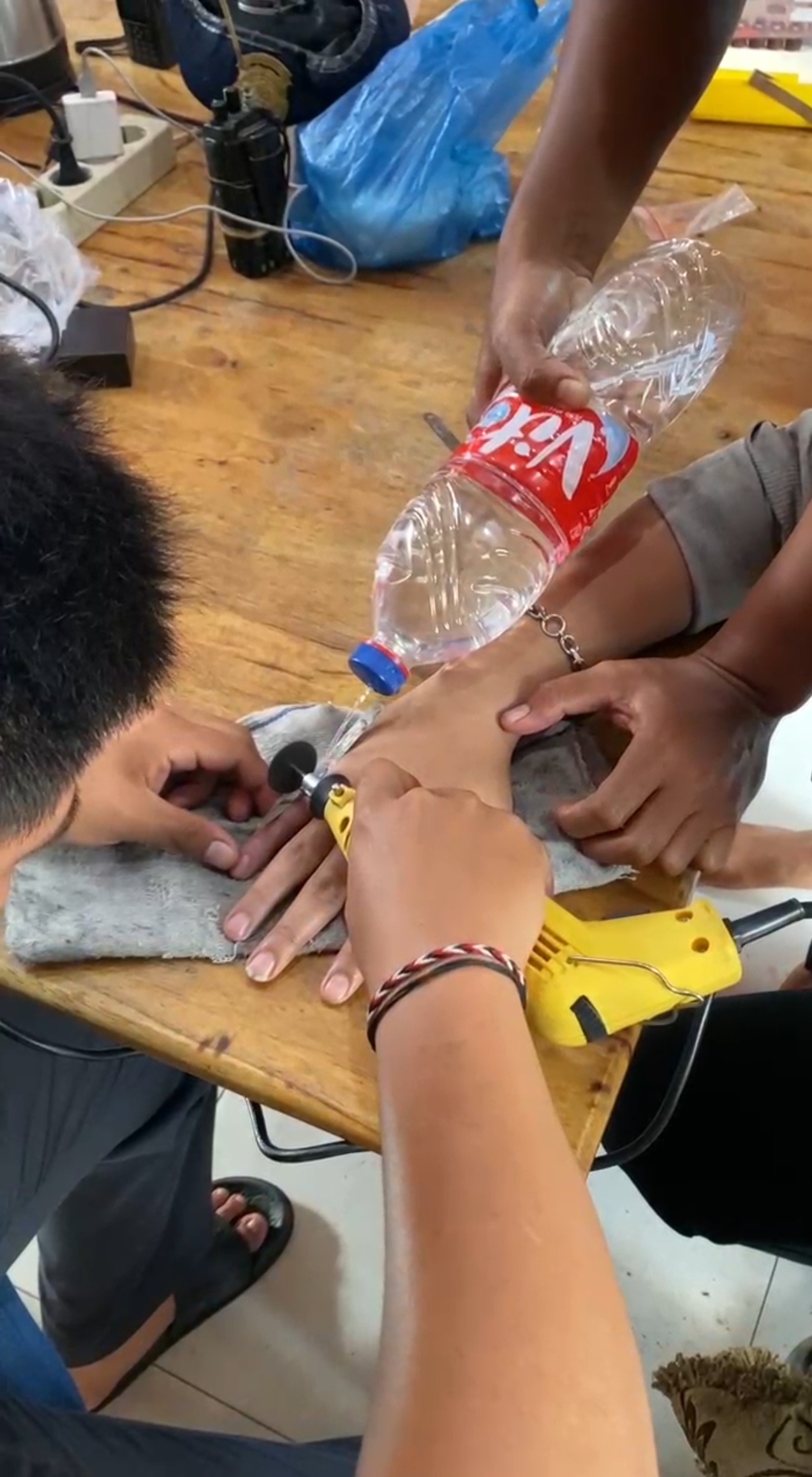 Penanganan Cincin