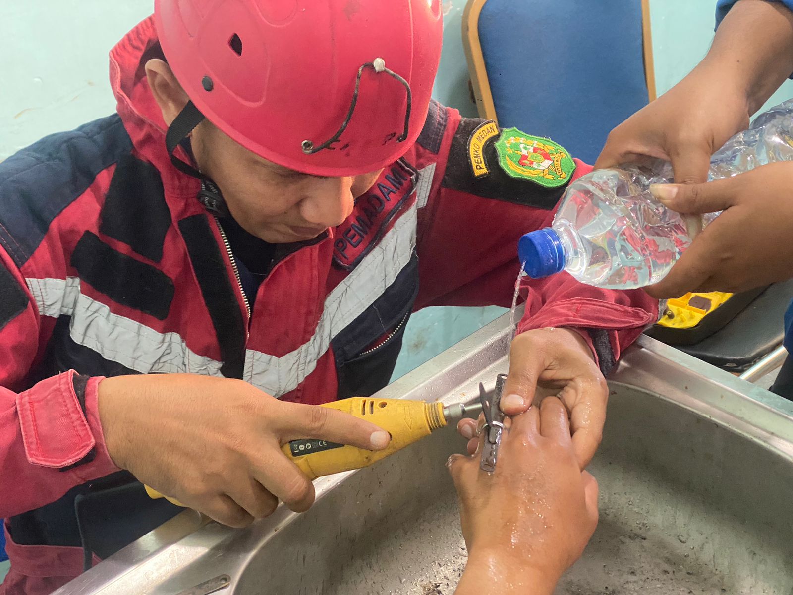 Pelepasan Cincin Dari Jari Tangan