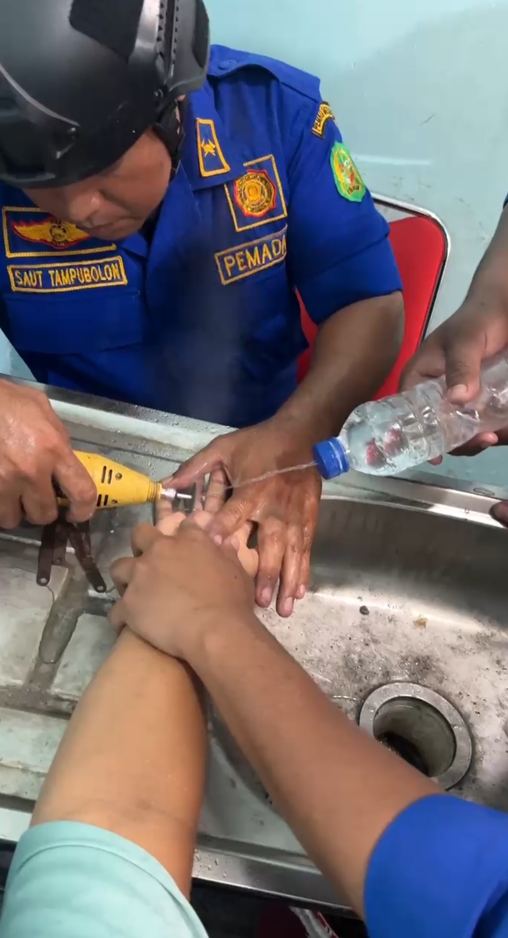 Penanganan Cincin
