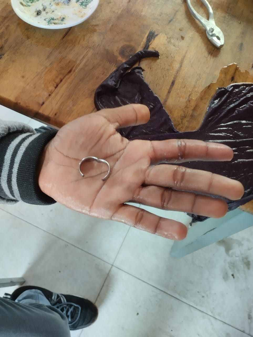 Penanganan Cincin