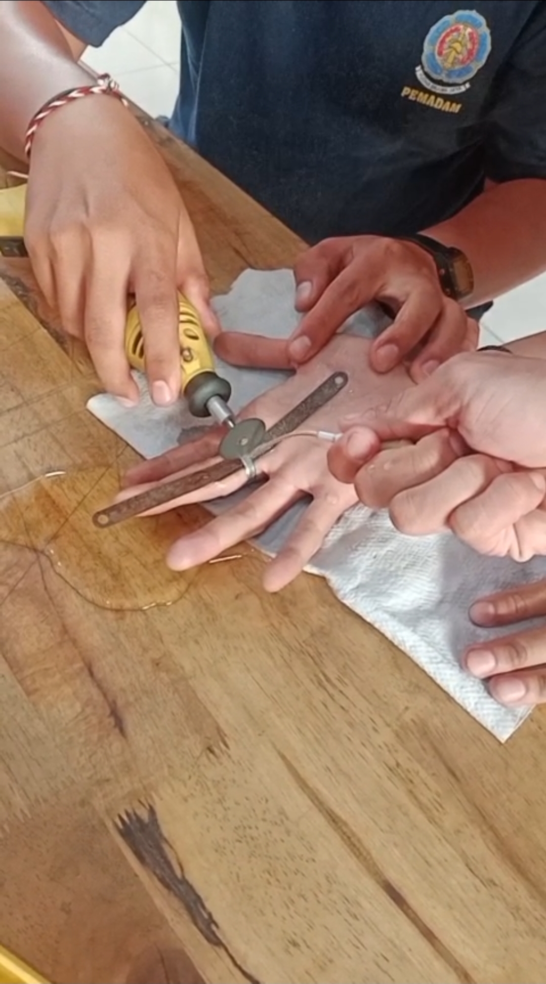 Penanganan Cincin
