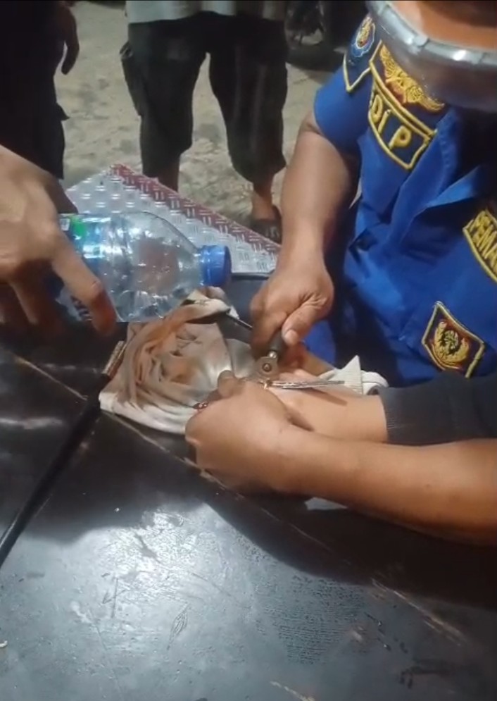 Pelepasan Cincin Dari Jari Tangan