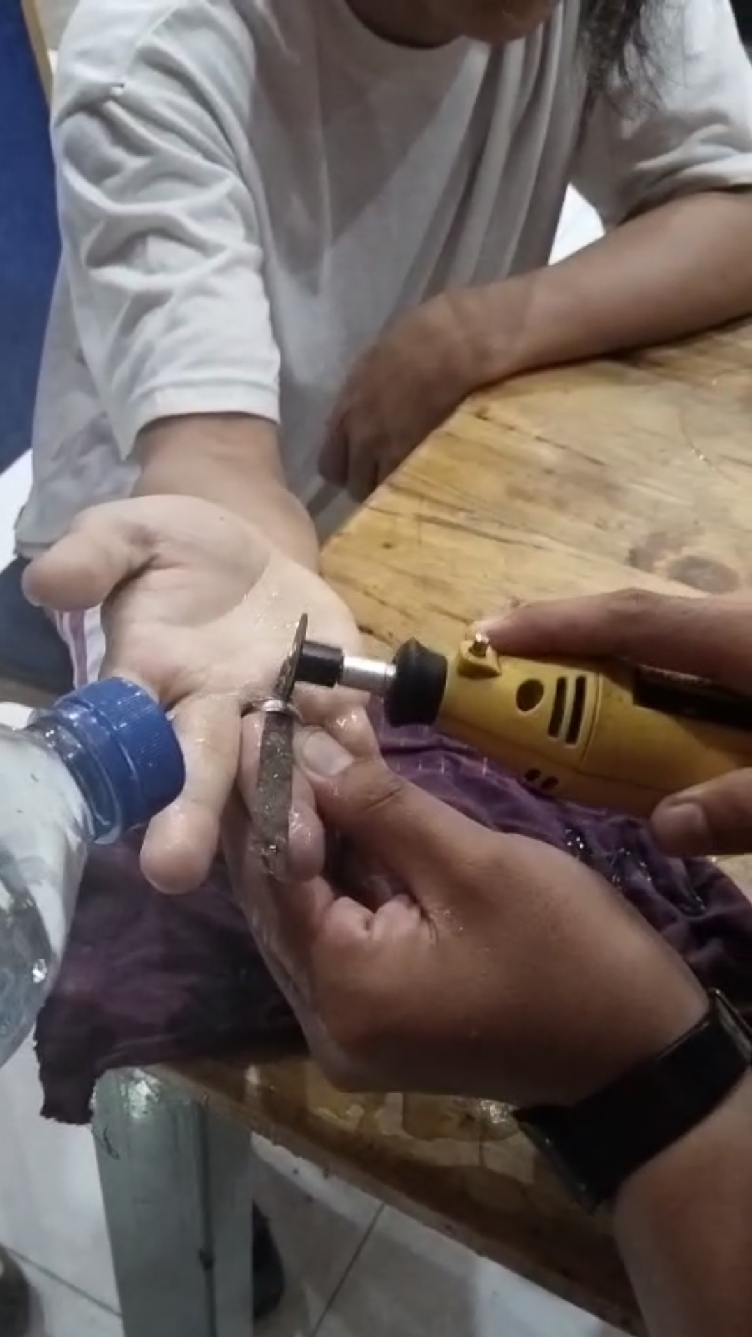 Penanganan Cincin