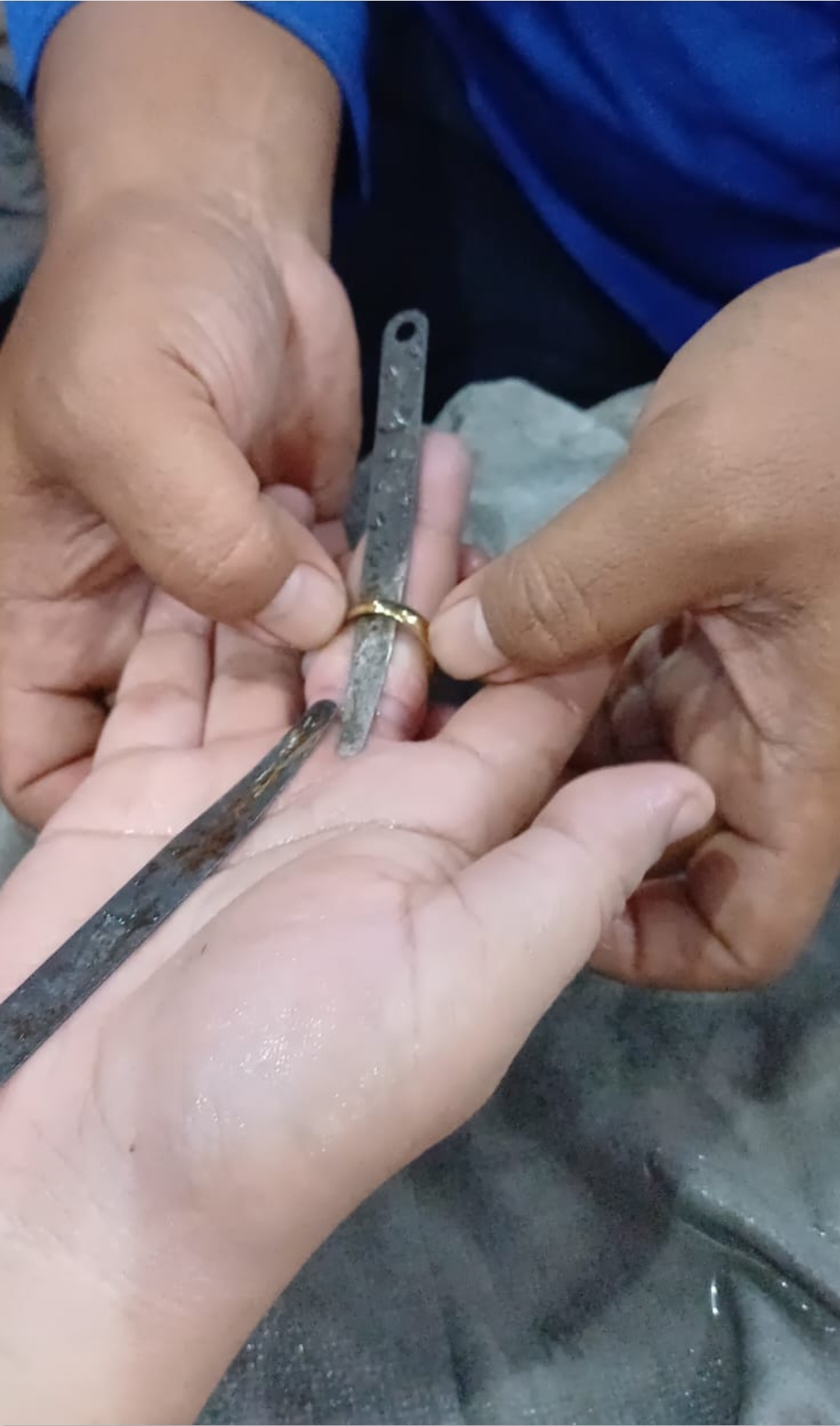 Penanganan Cincin