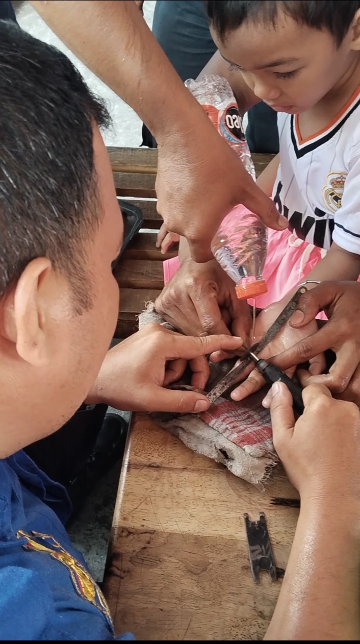 Pelepasan Besi dari Jari Tangan