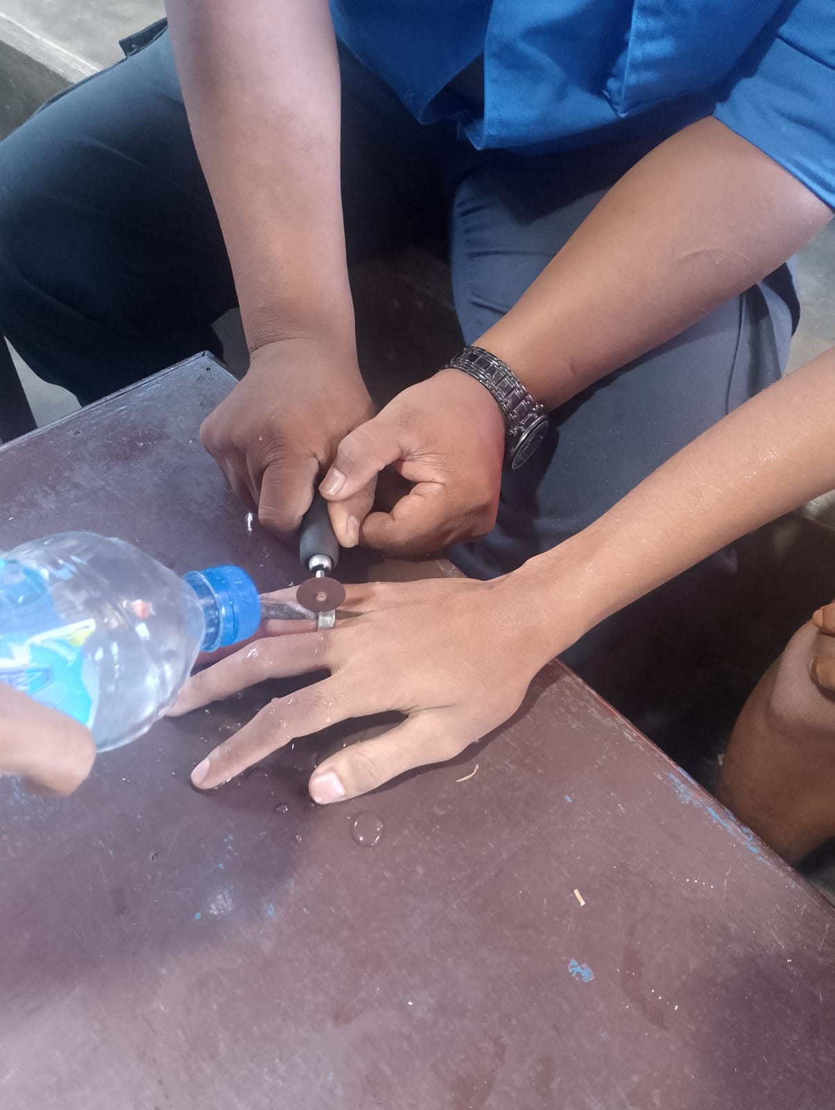 Pelepasan Cincin di Jari Tangan