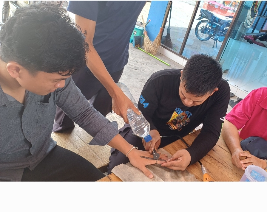 Penanganan Cincin